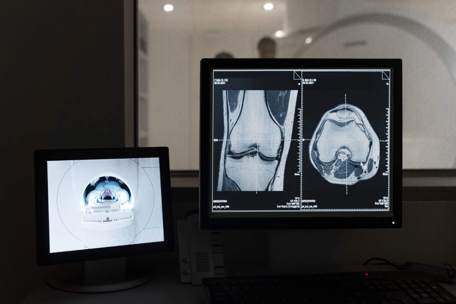 Transform radiology coding with Conrad AI for enhanced accuracy, efficiency, and revenue optimization now!