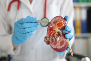 urology coding updates